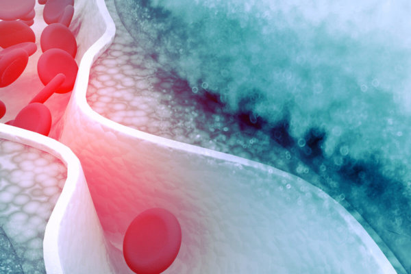 Het Keto-dieet en cholesterol