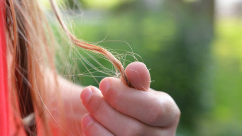 The Keto Diet and Hair Loss
