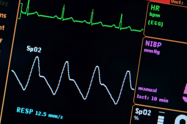 The Keto Diet & Heart Palpitations