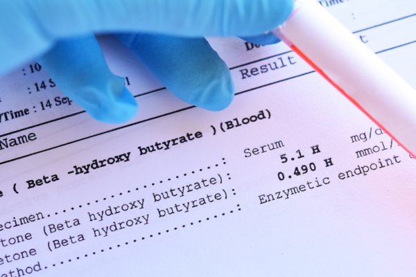 Ketose versus ketoacidose