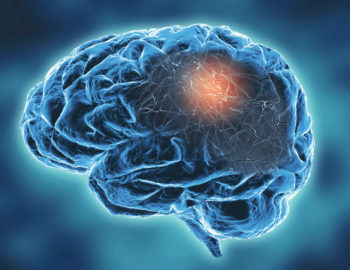 Brain Image