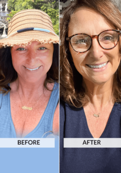 Før og efter-billede af Eileen Maxeys Keto-succeshistorie