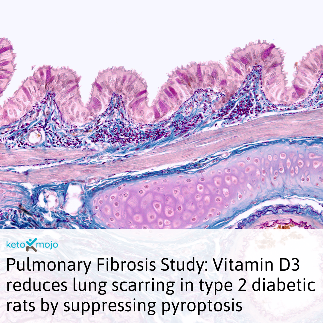 Pulmonary Fibrosis Study