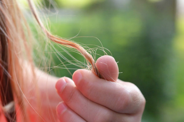 The Keto Diet & Hair Loss