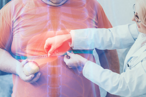 Can the Keto Diet Help with Fatty Liver Disease?