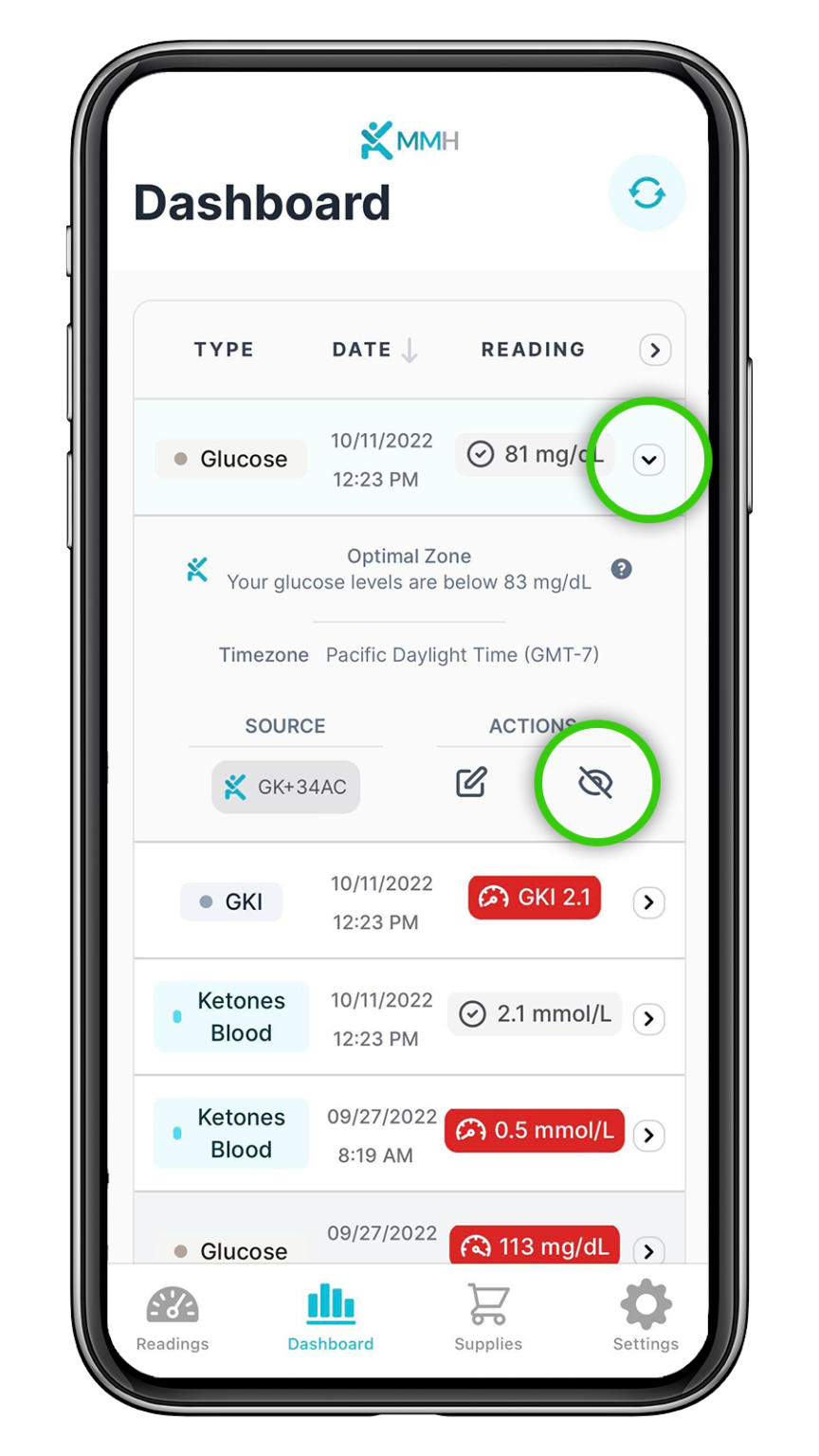 How to Manage Your Readings on the MyMojoHealth and KetoMojo Classic