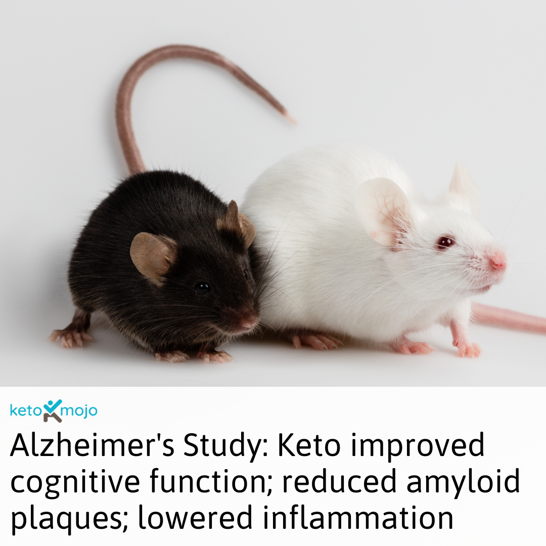 Alzheimer's study