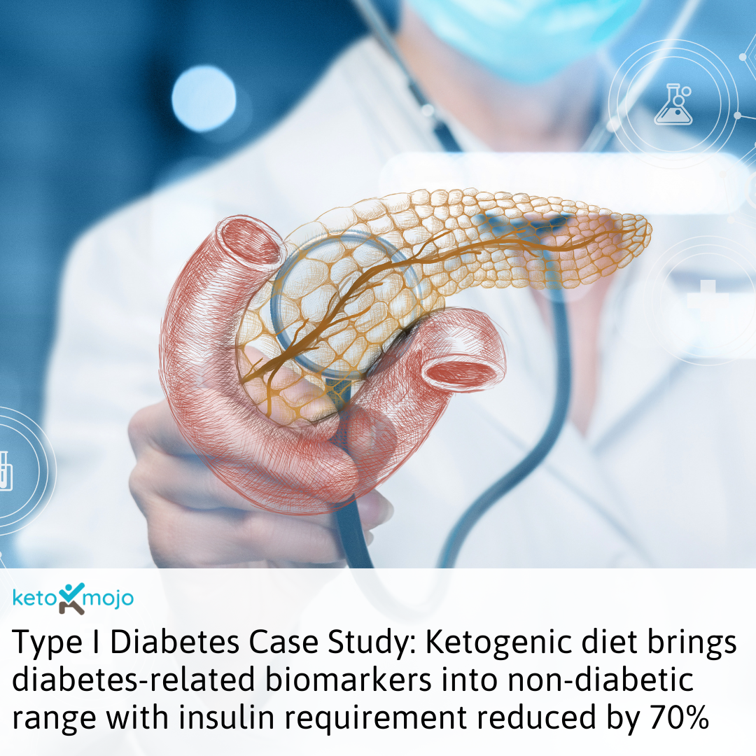 Research Case_Study_Keto_Type_I_Diabetes