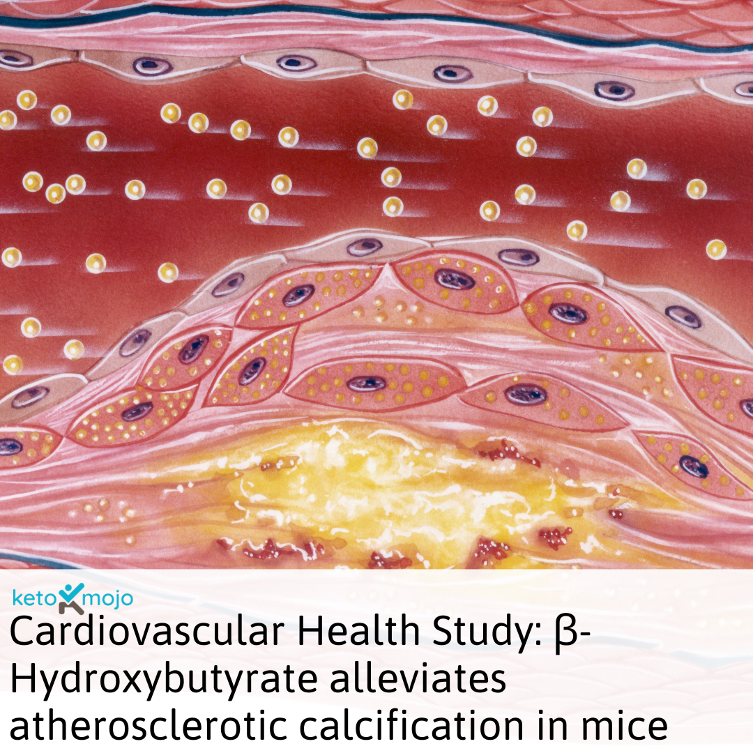 Research Atherosclerosis Study