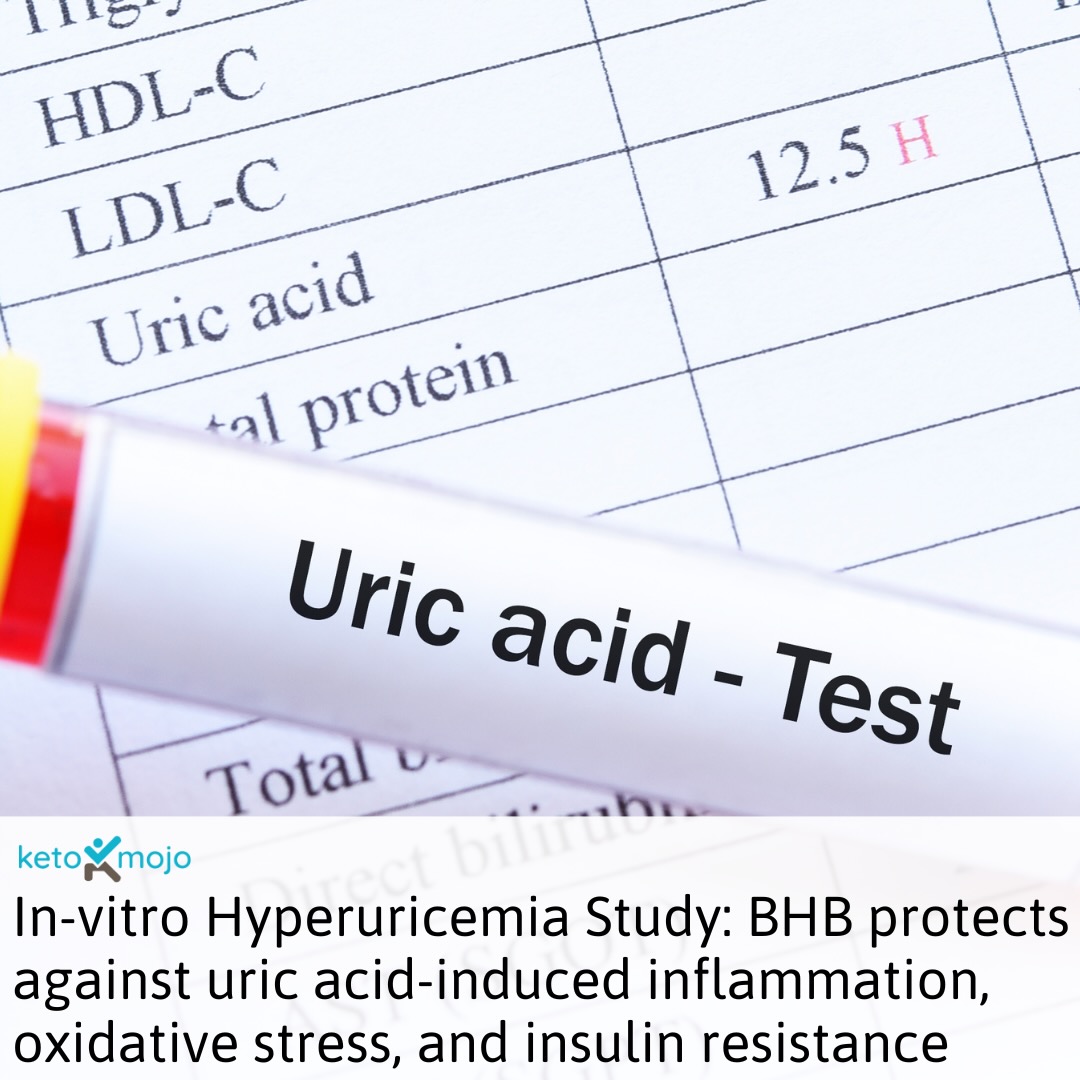 Research Uric Acid Study